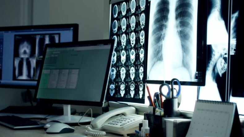Medical workstation displaying CT and chest X-ray images